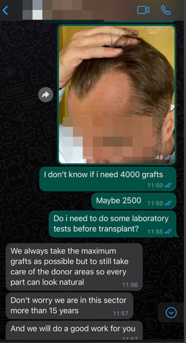 whatsapp 2 klinika za transplantaciju kose