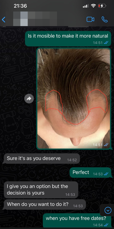 whatsapp klinika za transplantaciju kose 4