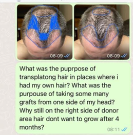 whatsapp poruka klinika za transplantaciju kose 6